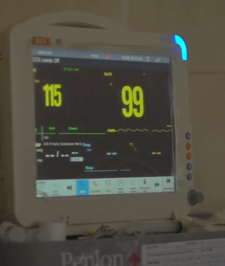 مراقبة العلامات الحيوية أثناء العملية